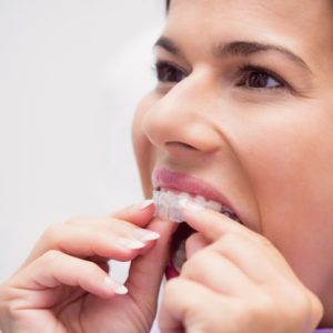 female-patient-wearing-braces_107420-65485